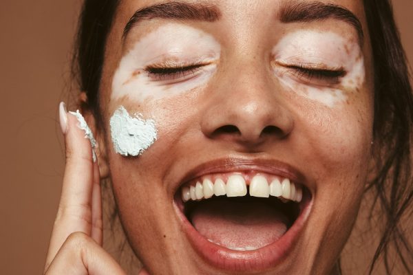 Is Your Skin Dry Dehydrated: Here is the best skincare routine for you