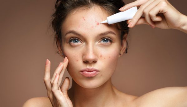 The Most Severe Form of Acne and How to Treat It