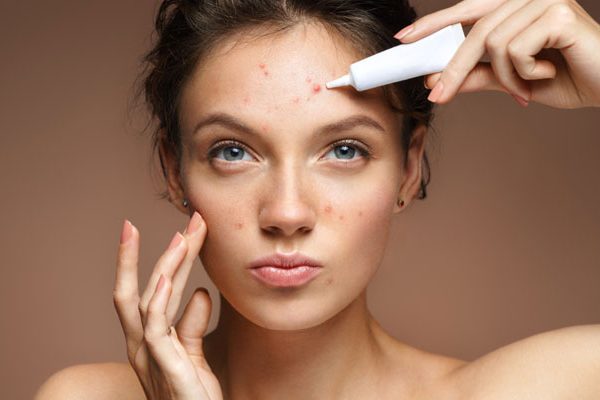 The Most Severe Form of Acne and How to Treat It