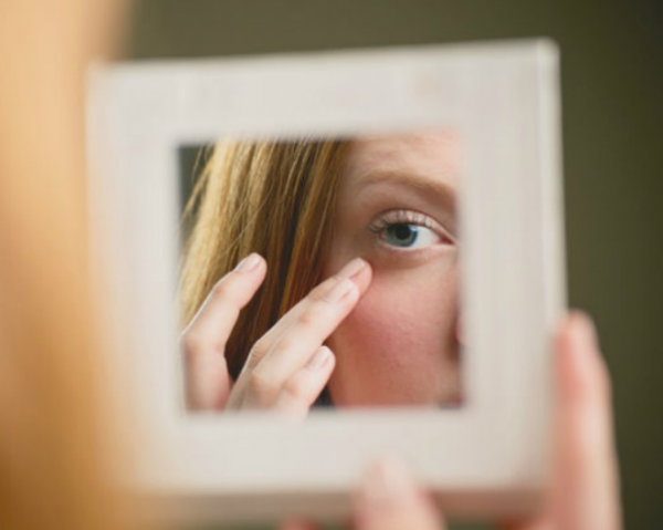 Skin Around The Eyes Concerns You Should Know About: tips and solutions
