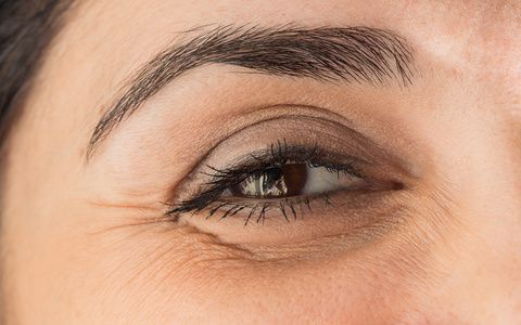 How Can I Reduce My Wrinkles?